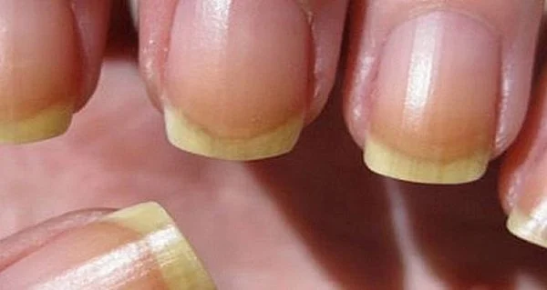 Significado de las uñas naranjas Descubre su simbolismo