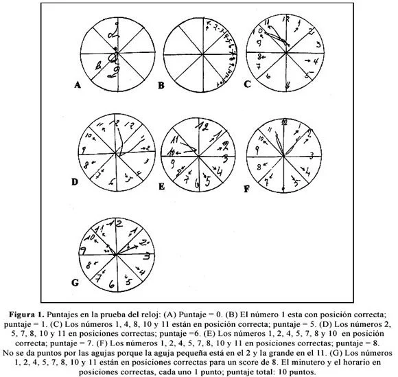 Interpretación óptima del test del reloj