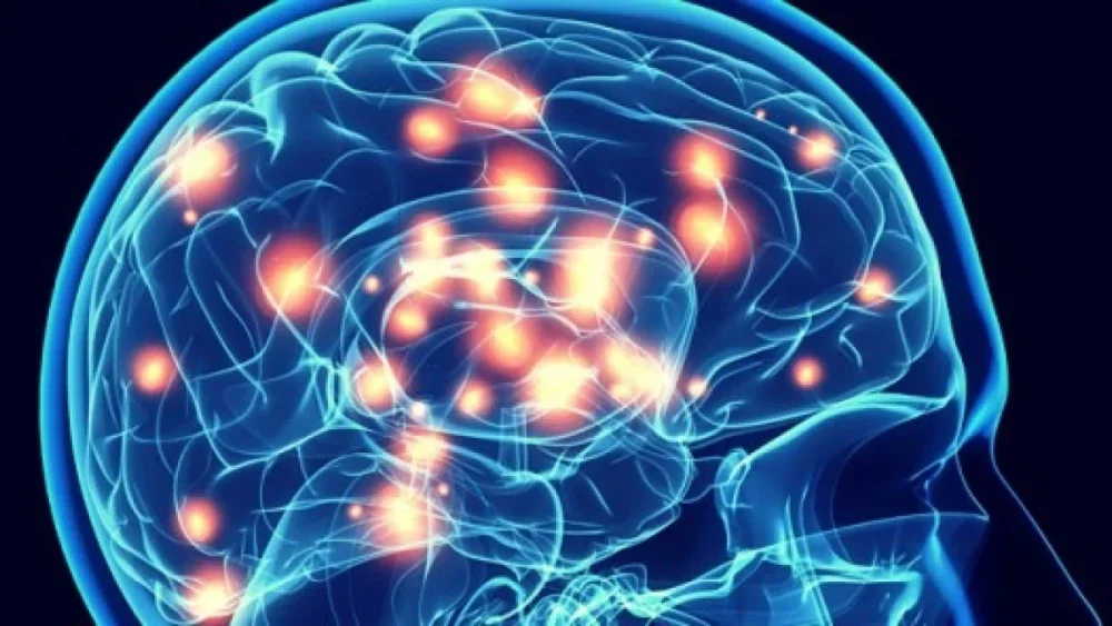 Optimización de intervención neuropsicológica en trastornos de la comunicación