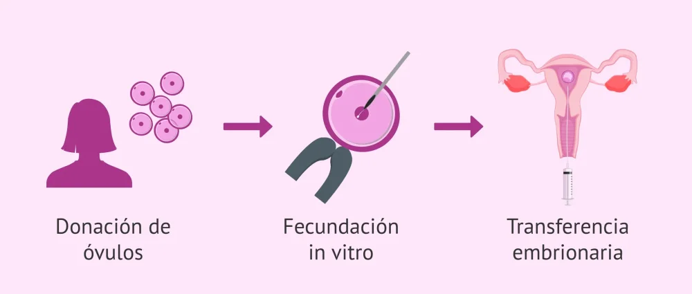 Superar la incertidumbre en donación de óvulos