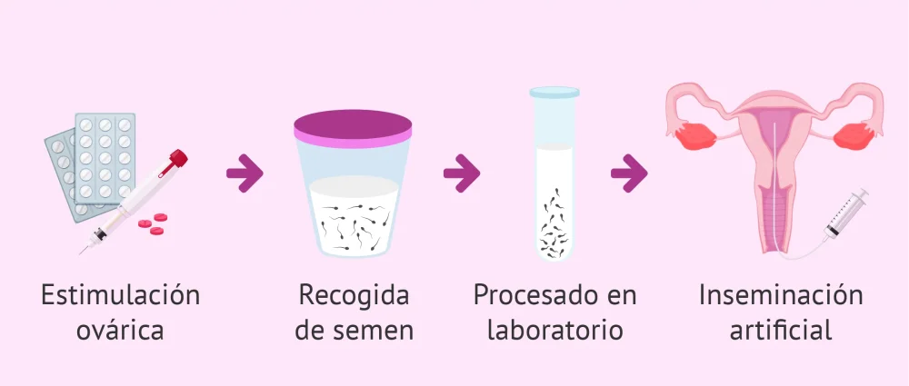 Terapia de pareja en la inseminación artificial