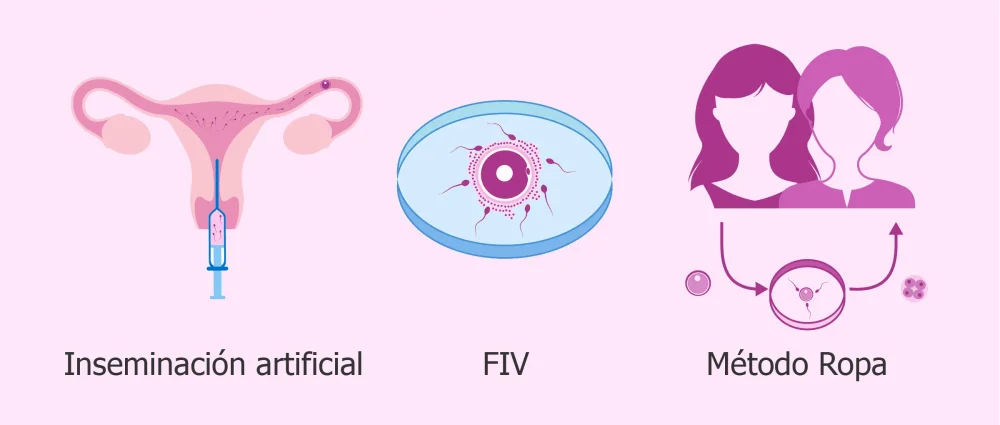 Terapia de pareja para fortalecer vínculos en inseminación artificial