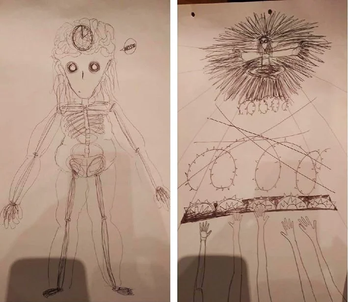 Terapia de arte en trastornos de la alimentación