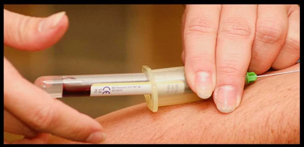 Consejos para evitar mareos al extraer sangre