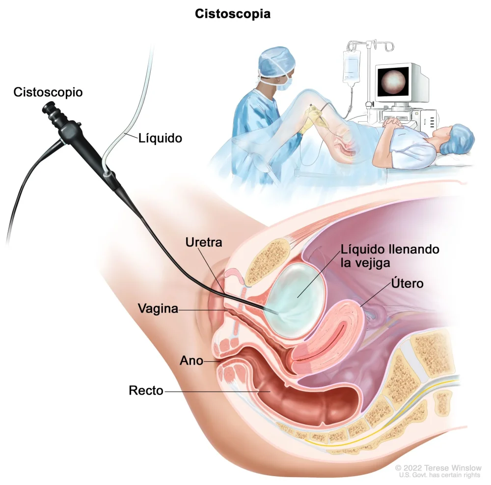 Diagnóstico de cáncer ¿Qué significa?
