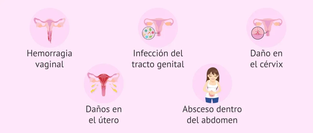 ¿Un ginecólogo puede detectar un aborto provocado?