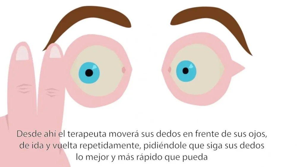 Terapia de Desensibilización y Reprocesamiento por Movimientos Oculares Enfoque Efectivo