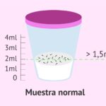 Diferencias en eyaculación ¿Por qué varía la cantidad?