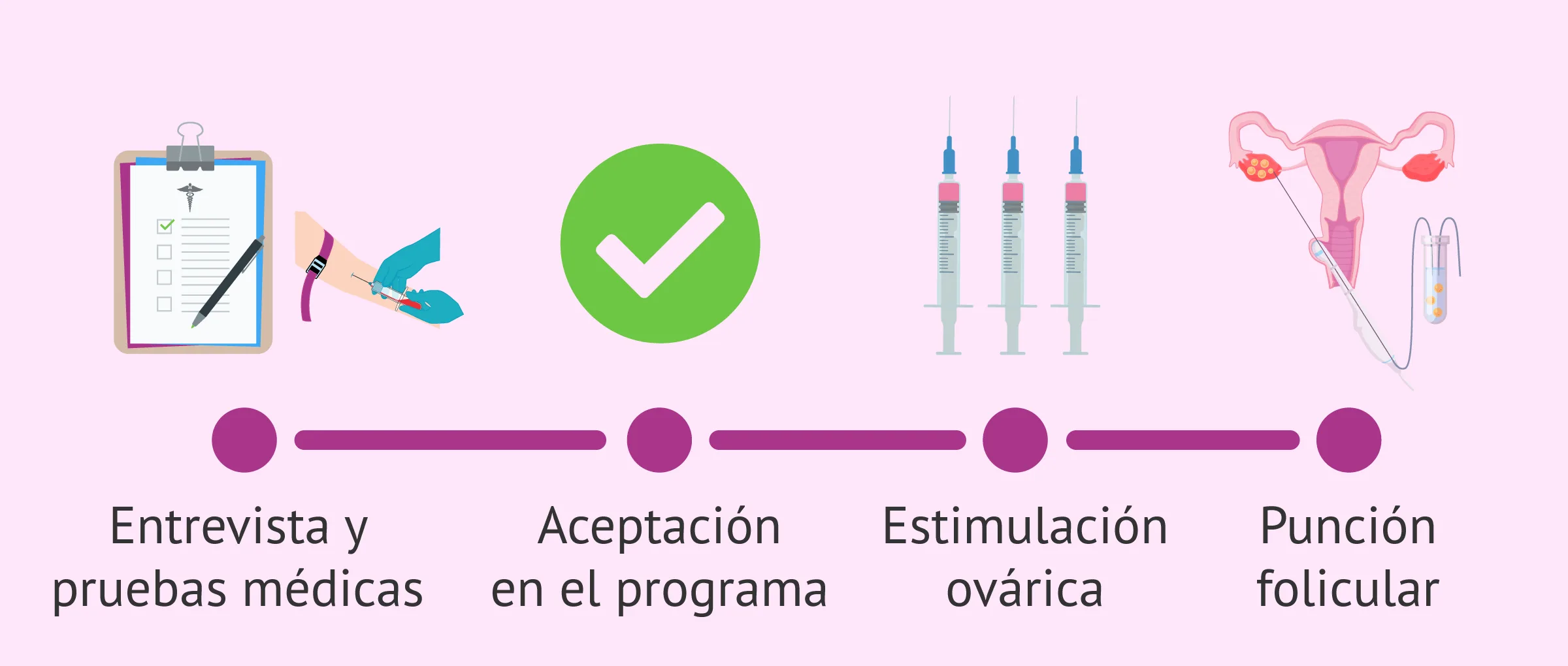 Consejos para lidiar con la presión en donación de óvulos